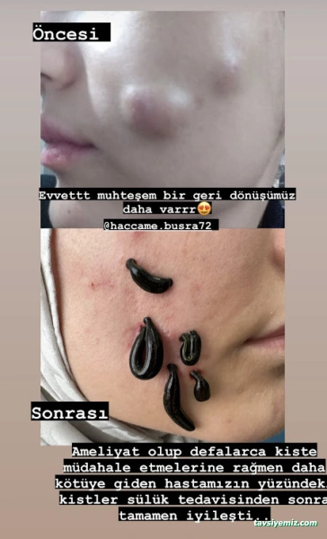 Batman Hacamat Ve Sülük Tedavi Merkezi