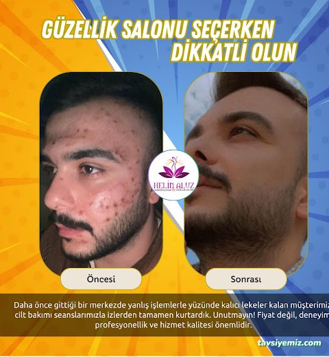 Helin Aluz Güzellik Merkezi