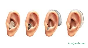 Bingöl E-Klinik İşitme Cihazları Satış Ve Uygulama Merkezi