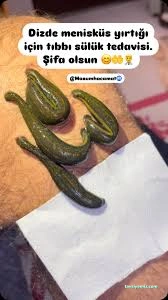 Bitlis Sülük İle Tedavi Merkezi