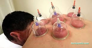 Bitlis Sülük İle Tedavi Merkezi