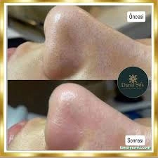 Bolu Darül Şifa Güzellik Salonu