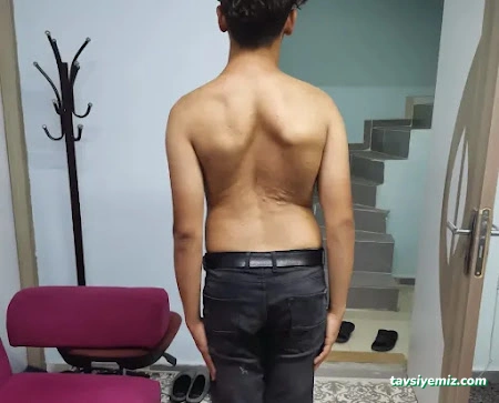 Bursa Hacamat Merkezi, Manuel Terapi(Boyun Fıtığı, Bel Fıtığı, Sırt Ağrıları), Sülük Tedavisi