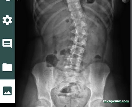 Bursa Hacamat Merkezi, Manuel Terapi(Boyun Fıtığı, Bel Fıtığı, Sırt Ağrıları), Sülük Tedavisi