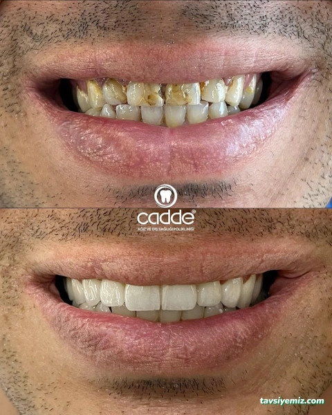 Cadde Plus Diş Polikliniği - Adıyaman