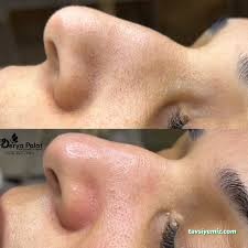 Derya Polat Vip Güzellik&Estetik