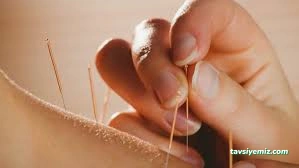 Çanakkale Akupunktur