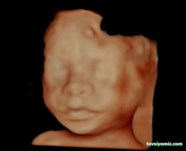 Prof.dr.aytül Çorbacıoğlu -Perinatoloji Ve Kadın Hastalıkları Ve Doğum Uzmanı