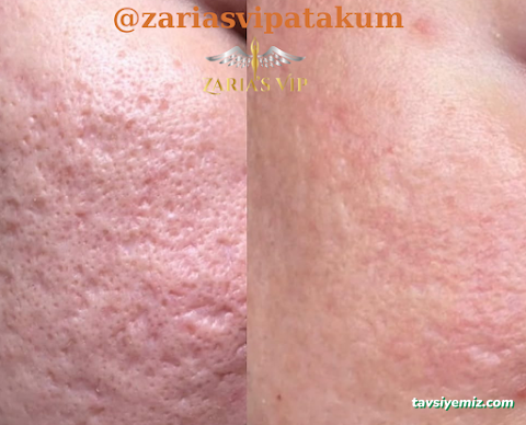 Zaria's Vip Lazer Epilasyon Ve Zayıflama Merkezi