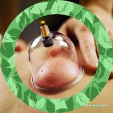 Çorum Bayan Hacamat