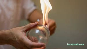 Çorum Bayan Hacamat