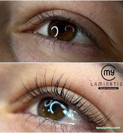 Özlem Özge Güzellik