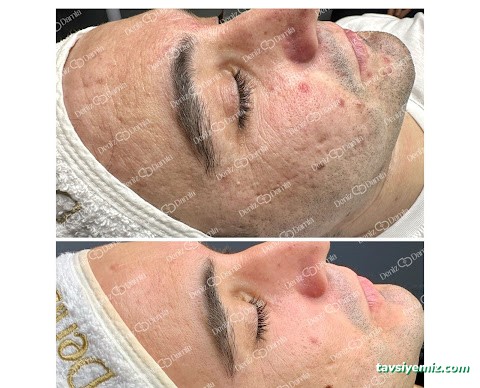 Deniz Damla Çukurambar | Ankara Cilt Bakımı | Ankara Lazer Epilasyon | Kalıcı Makyaj | Protez Tırnak