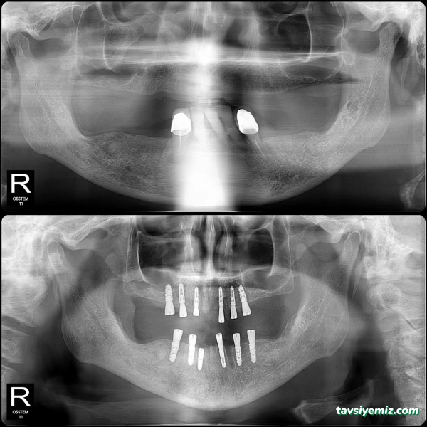 Dent Avrupa Özel Ağız Diş Sağlığı Polikliniği