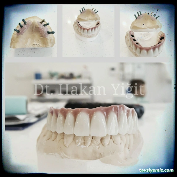Denta Merzifon Özel Ağız Ve Diş Sağlığı Polikliniği Dt. Hakan Yiğit Dt. Oğuzhan Toygar