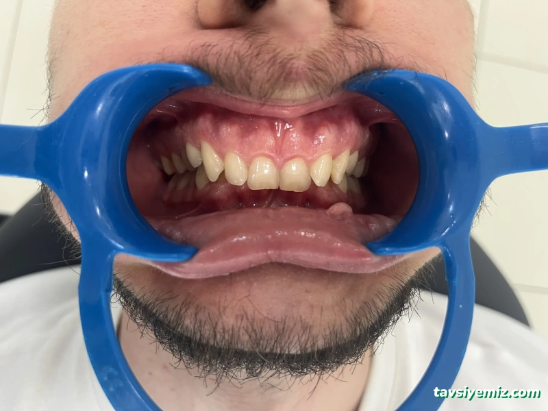 Dentriva Diş Yahyakaptan – İzmit