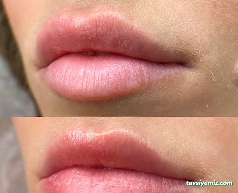 Esze Güzellik Merkezi