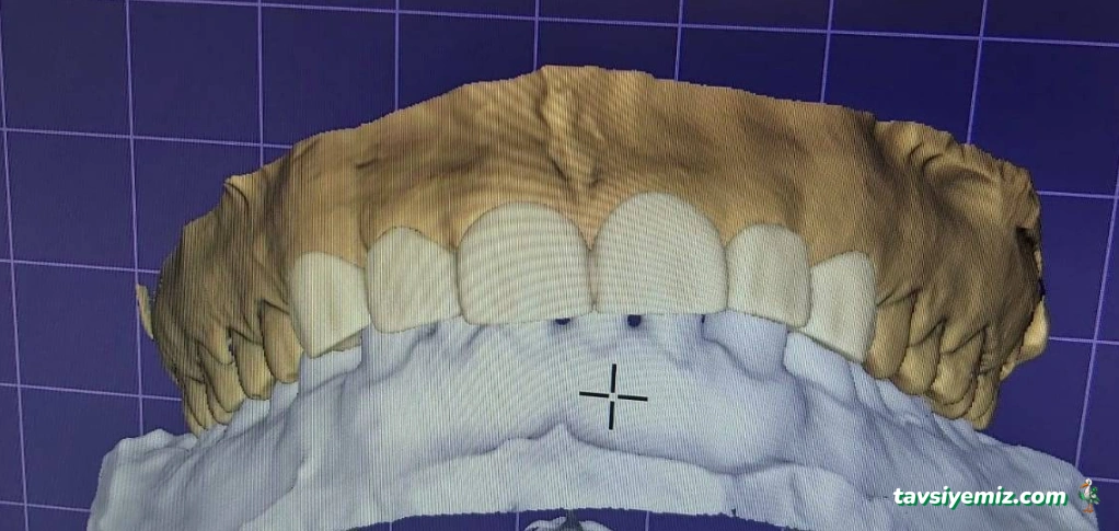 Diş Hekimi Erdal Çiftçi Diş Hekimi Emre Çetin