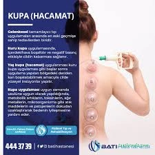 Diyarbakır Kayapınar Hacamat & Tıbbi Sülük