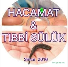 Diyarbakır Kayapınar Hacamat & Tıbbi Sülük