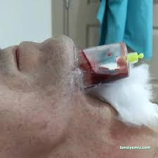 Diyarbakır Kayapınar Hacamat & Tıbbi Sülük