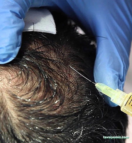 Dr. Bulut Demirci Geleneksel Ve Tamamlayıcı Tıp Ünitesi