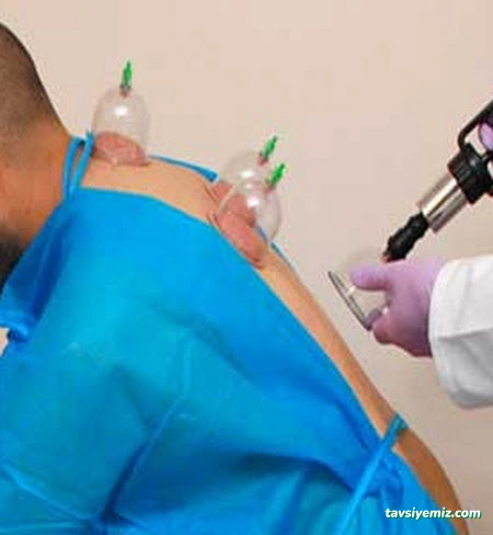 Dr. Mehmet Özkent | İzmir Hacamat Tedavisi | Ozon Terapi | Sülük Tedavisi