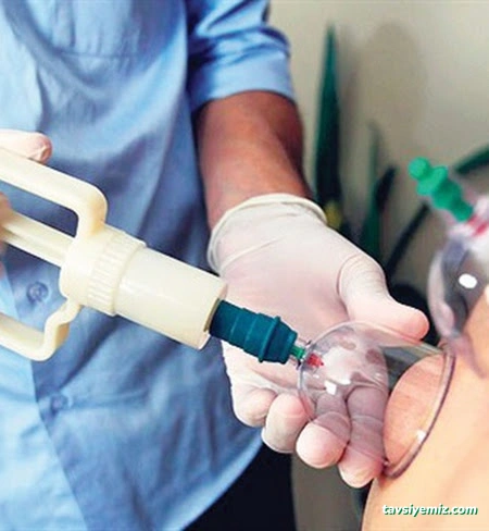 Dr. Mehmet Özkent | İzmir Hacamat Tedavisi | Ozon Terapi | Sülük Tedavisi