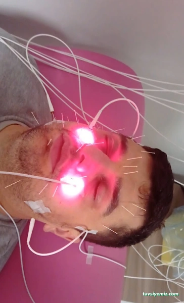 Dr. Nilgün Özönder-Akupunktur