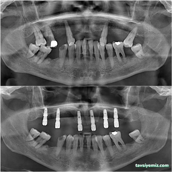Ds Albayrak Ağız Ve Diş Sağlığı Polikliniği - Denizli Diş