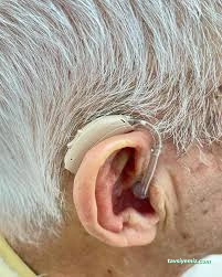 Duysev İşitme Cihazları (Aksaray İşitme Cihazları)