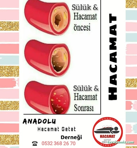 Elazığ Anadolu Hacamat Getat Derneği