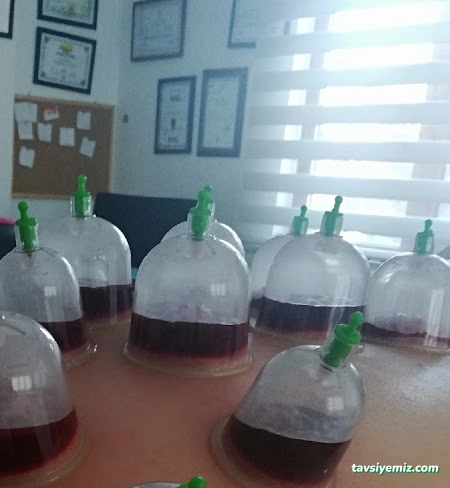 Elazığ Anadolu Hacamat Getat Derneği