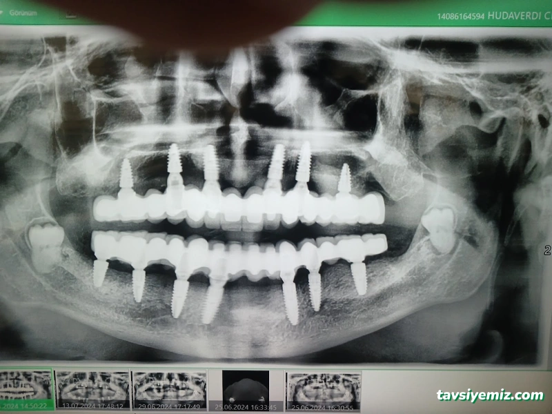 Ersöz Ağız Diş Sağlığı Merkezi