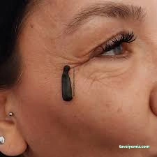 Erzincan Bayan Hacamat