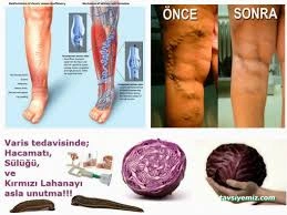 Erzincan Bayan Hacamat