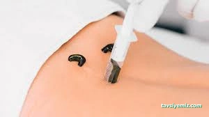 Erzurum Hacamat Ve Alternatif Tıp Danışmanlığı (Yalnızca Bayanlara)