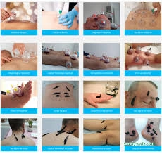 Erzurum Hacamat Ve Alternatif Tıp Danışmanlığı (Yalnızca Bayanlara)