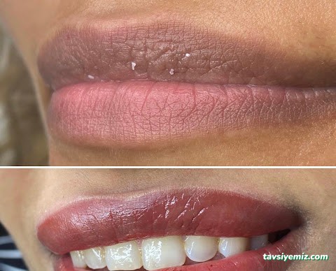 Estedermal Sivas Güzellik Salonu