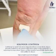 Fizyobolu Fizyoterapi, Manuel Terapi Danışmanlık