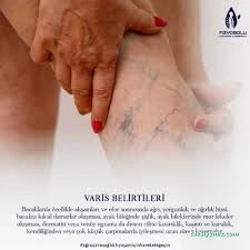 Fizyobolu Fizyoterapi, Manuel Terapi Danışmanlık