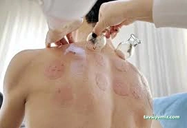 Gaziantep Hacamat Tıp Merkezi