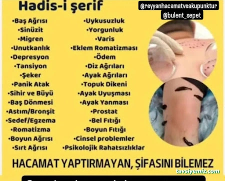 Gaziantep Reyyan Hacamat Ve Akupunktur