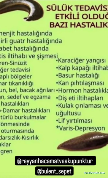 Gaziantep Reyyan Hacamat Ve Akupunktur