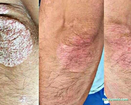 Gizli Bahçe Lokman Hekim Doğal Yaşam