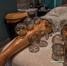 Gümüş Hacamat Amasya