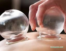 Gümüş Hacamat Amasya