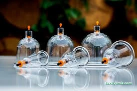 Gümüş Hacamat Amasya