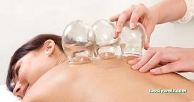 Gümüş Hacamat Amasya