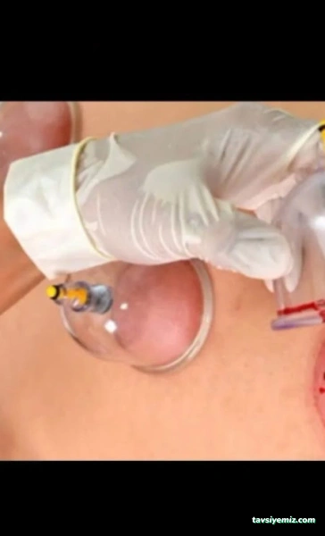 Hacamat Sağlıklı Yaşam Merkezi Aksaray68